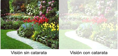 visionconysincatarata