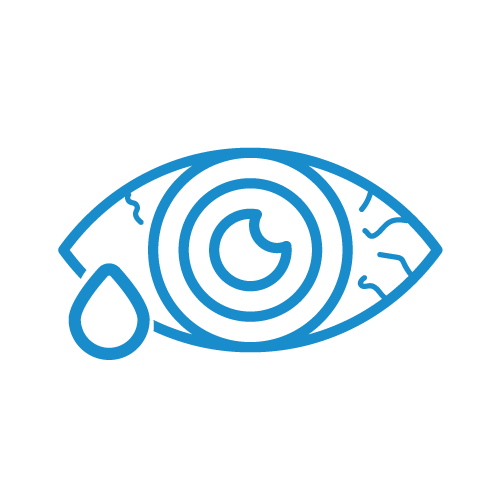 Fatiga Ocular | Icono | Khroma | Lasik - Oftalmolaser - Oftalmologia laser - Cirugia Laser de Ojos - Cirugia Laser - Cirugía Miopía