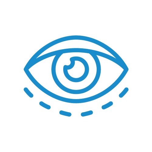 Blefaroplastía Inferior | Icono | Khroma Visión | Oftalmologos Especialistas - Cirugía de Ojos - Cirugia de Cataratas - Cirugía de Ojos Monterrey