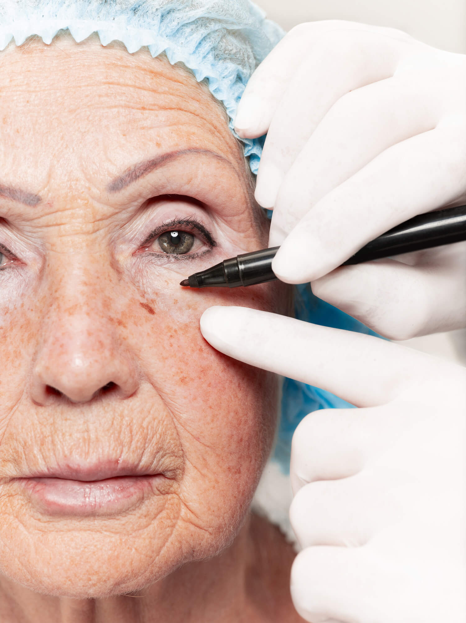 Khroma Visión | Oftalmologos Especialistas - Cirugía de Ojos - Cirugia de Cataratas - Cirugía de Ojos Monterrey